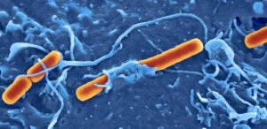 Sexually Transmitted Diarrhea Disease Emergency 2026: 7 Critical Facts On Rising Drug Resistance